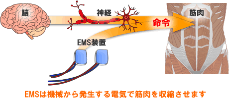 EMSは機械から発生する電気で筋肉を収縮させます